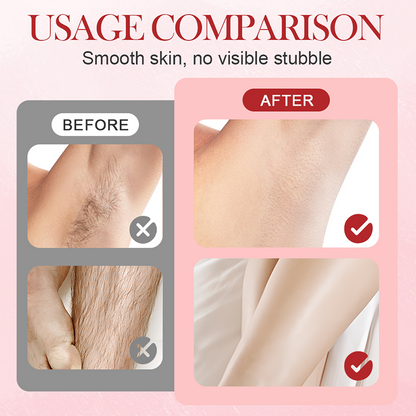 Deals-Portable Dual-Head Electric Epilator